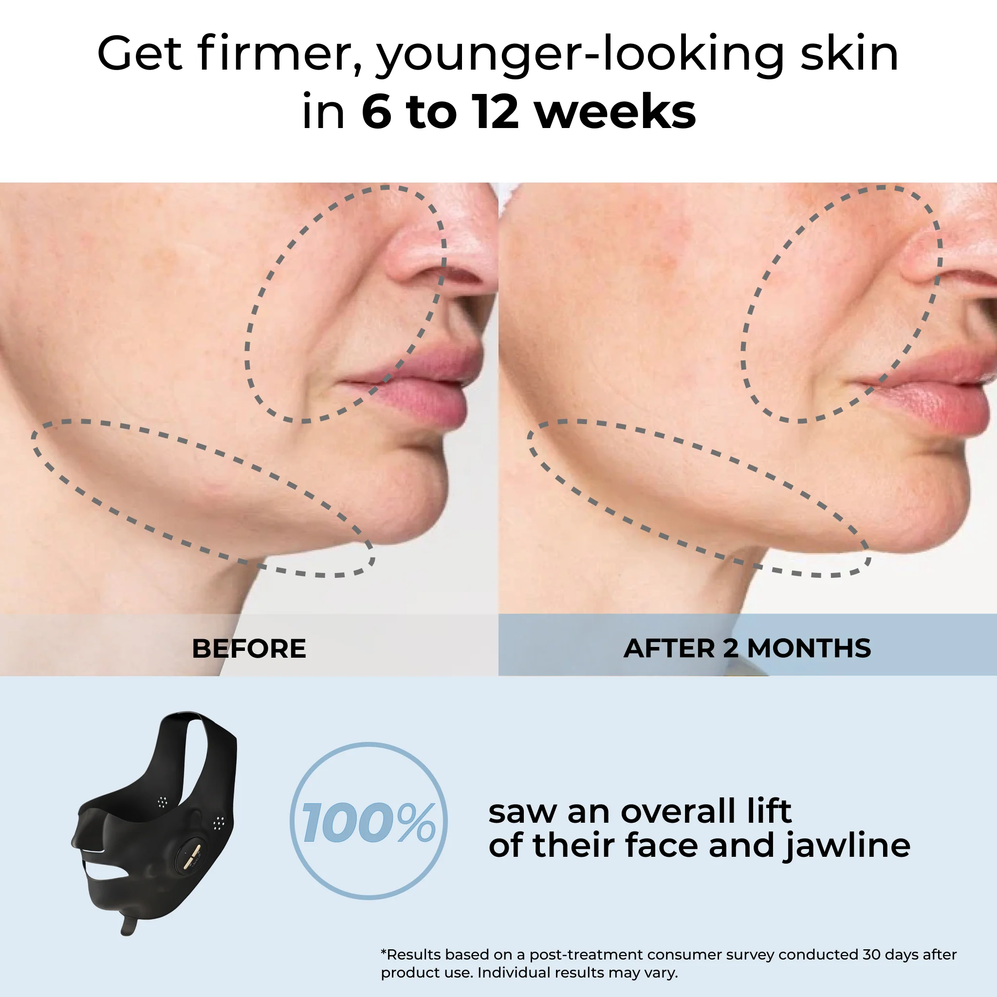 Luxe Lift Mask Bundle (Black Pulse) - Image 4