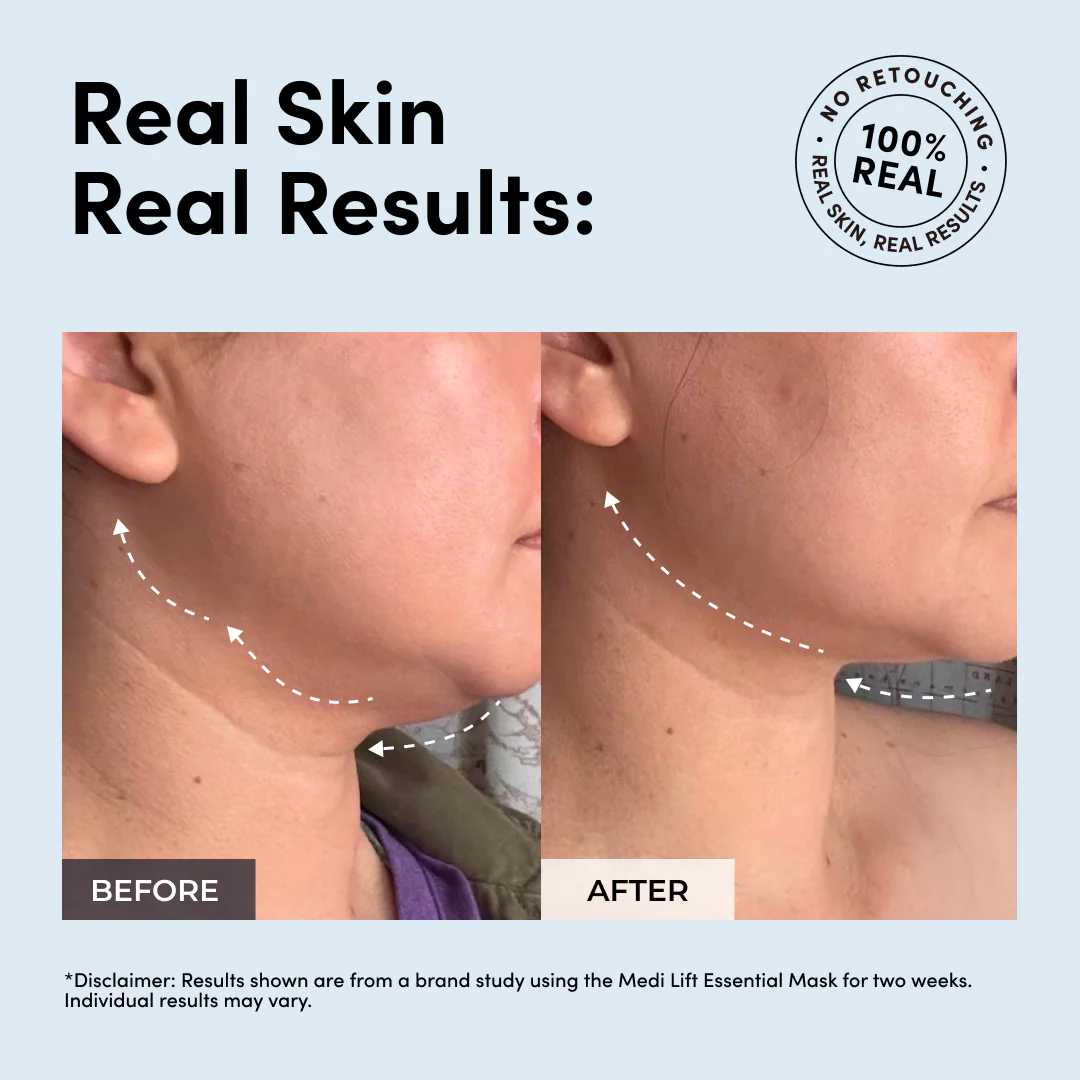 Luxe Lift Mask Bundle (Black Pulse) - Image 3