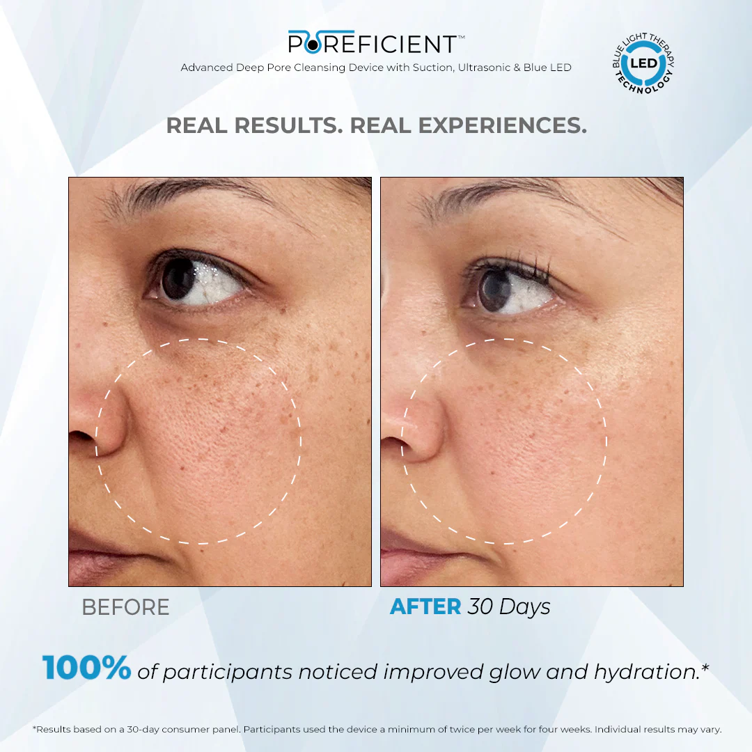 POREFICIENT™ - Image 3