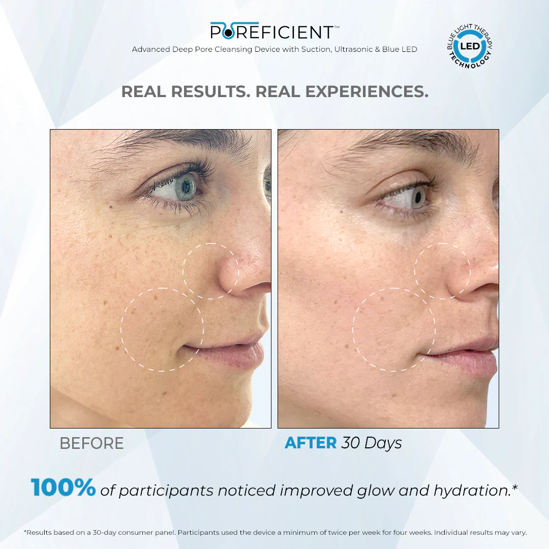 POREFICIENT™ - Image 6