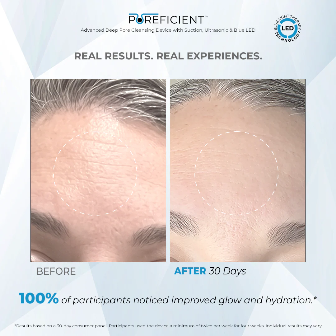 POREFICIENT™ - Image 8